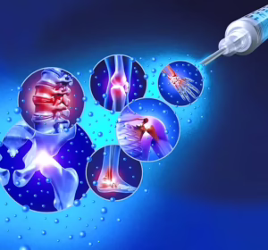Regenerative medicine illustration representing injection-based pain treatment