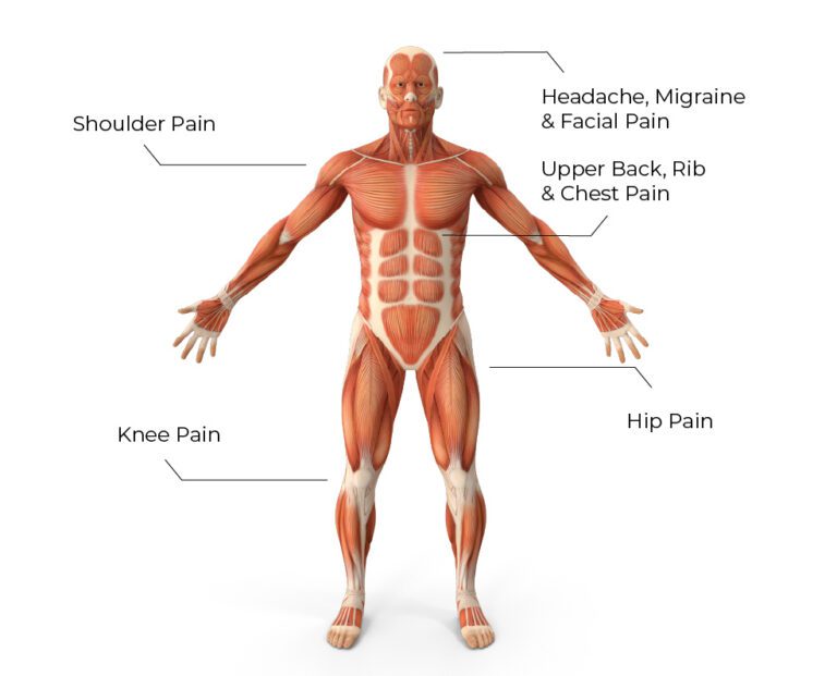 Body pain diagram showing common headache, joint, back, and limb pain areas